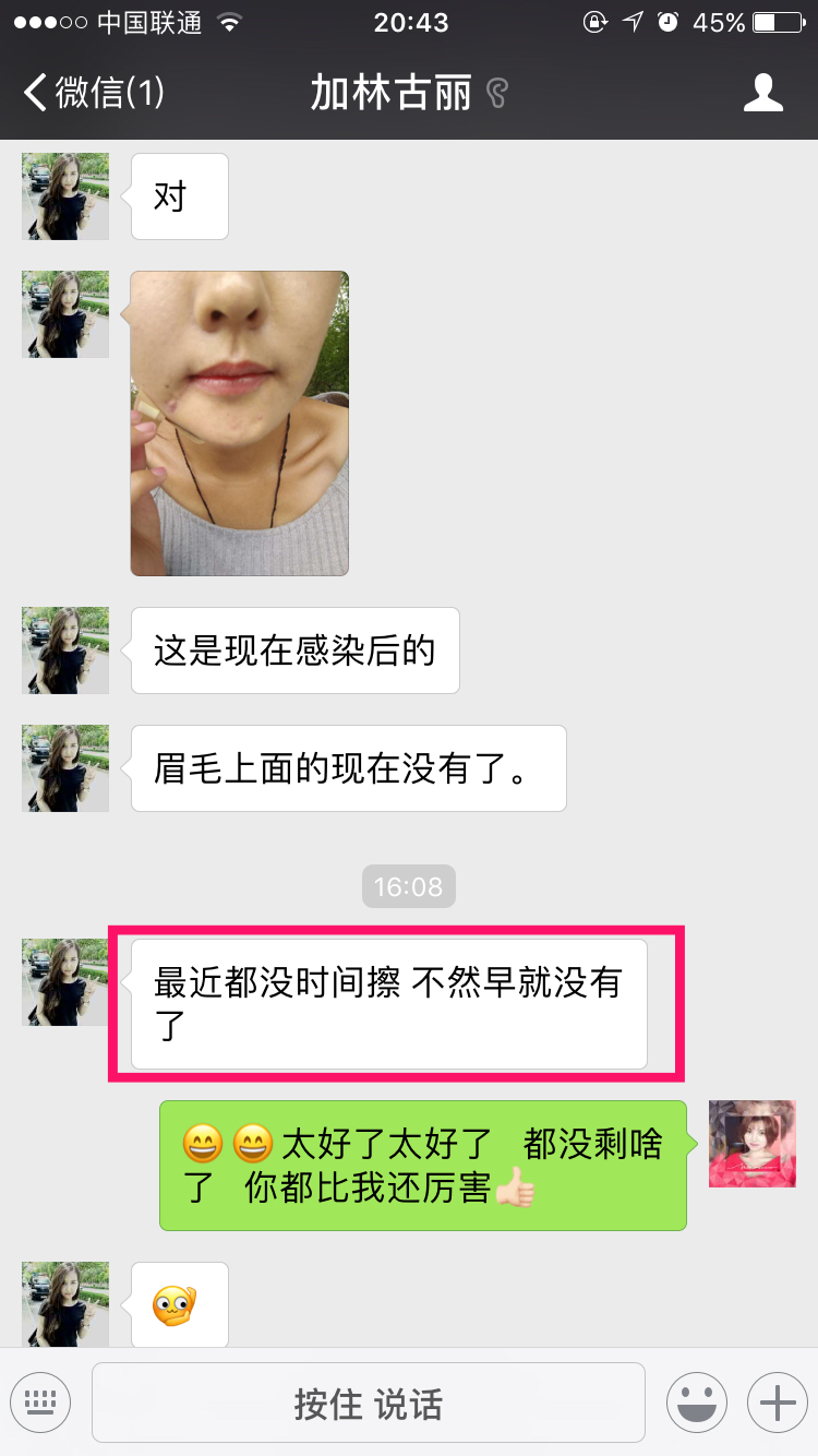 好心情好反馈 很开心可痕能帮到这位美女，车祸后她面临的不仅是面部修复，还有心理重建，很幸运，可痕不仅修复了疤痕，还帮她找回了自信，看到最后一张照片，你就明白可痕存在的意义了。而她也同意我们能把她的经历分享给大家，希望能帮助更多的人！